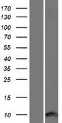 Western Blot: ICEBERG Overexpression Lysate [NBP2-06534]