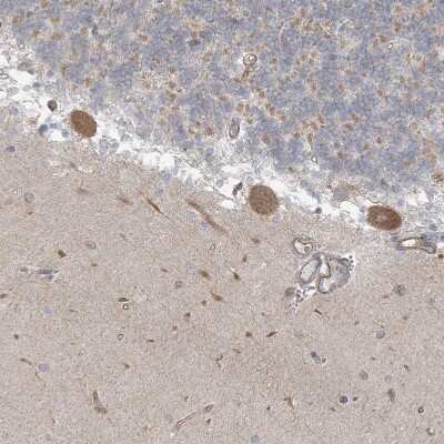 Immunohistochemistry-Paraffin: ICMT Antibody [NBP1-91795]