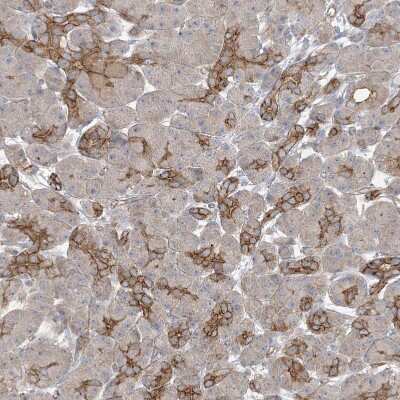 Immunohistochemistry-Paraffin: ICMT Antibody [NBP1-91795]