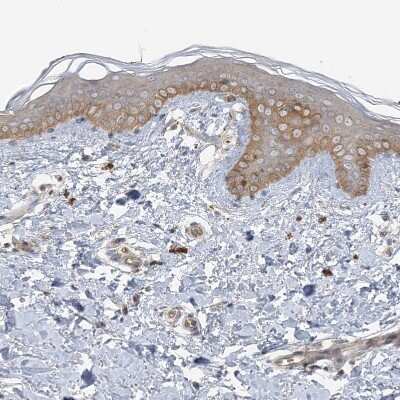 Immunohistochemistry-Paraffin: ICMT Antibody [NBP1-91795]