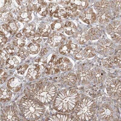 Immunohistochemistry-Paraffin: ICMT Antibody [NBP1-91795]
