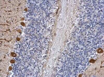 Immunohistochemistry-Paraffin: ICMT Antibody [NBP2-42865]