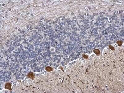 Immunohistochemistry-Paraffin: ICMT Antibody [NBP2-42865]