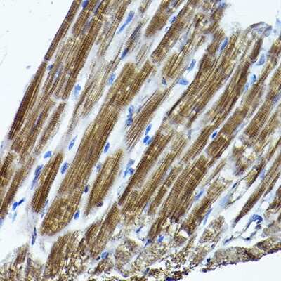 Immunohistochemistry-Paraffin: ICMT Antibody - BSA Free [NBP3-04787]