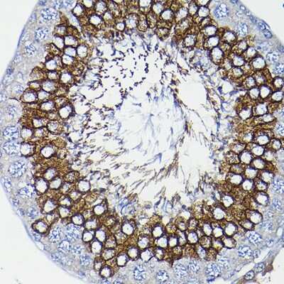 Immunohistochemistry-Paraffin: ICMT Antibody - BSA Free [NBP3-04787]