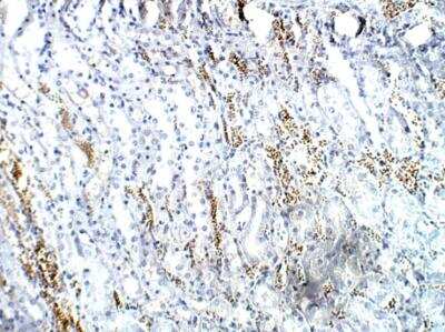 Immunohistochemistry-Paraffin: ICMT Antibody [NBP3-12316]