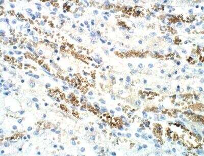 Immunohistochemistry-Paraffin: ICMT Antibody [NBP3-12316]