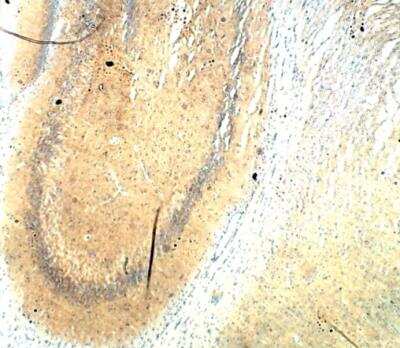 Immunohistochemistry-Paraffin: ICMT Antibody [NBP3-12316]