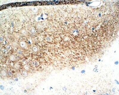 Immunohistochemistry-Paraffin: ICMT Antibody [NBP3-12316]