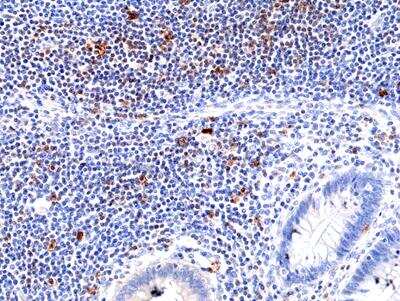 Immunohistochemistry-Paraffin: ICOS Antibody (RM417) [NBP2-89090]