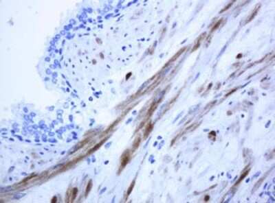 Immunohistochemistry: ICT Antibody (OTI2F9) [NBP2-45747]