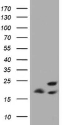 Western Blot: ICT Antibody (OTI2F9) [NBP2-45747]