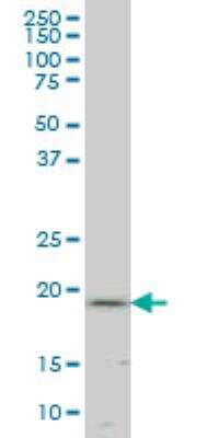 Western Blot: ICT Antibody (4C10) [H00003396-M06]