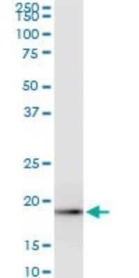 Western Blot: ICT Antibody (6F8) [H00003396-M05]