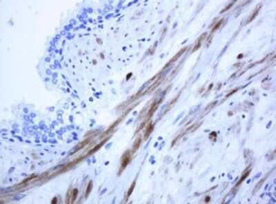 Immunohistochemistry: ICT Antibody (OTI2F9) - Azide and BSA Free [NBP2-70976]