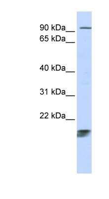 Western Blot: ICT Antibody [NBP1-55014]