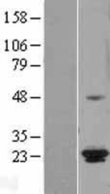 Western Blot: ICT Overexpression Lysate [NBL1-11812]