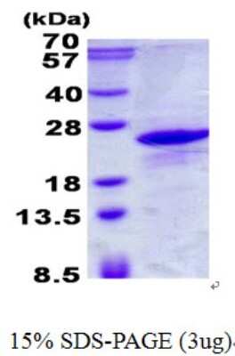 SDS-PAGE: Recombinant Human ICT His Protein [NBP2-23129]