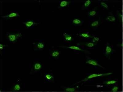 Immunocytochemistry/ Immunofluorescence: ID1 Antibody (3A9) [H00003397-M10]