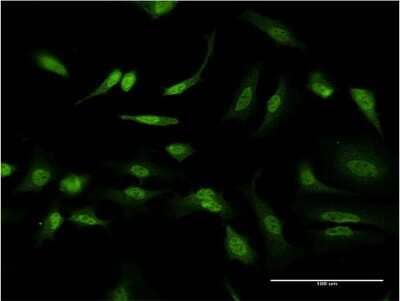 Immunocytochemistry/ Immunofluorescence: ID1 Antibody (3F3) [H00003397-M14]