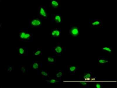 Immunocytochemistry/ Immunofluorescence: ID1 Antibody (4G11) [H00003397-M04]