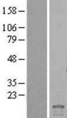 Western Blot: ID2 Overexpression Lysate [NBL1-11814]