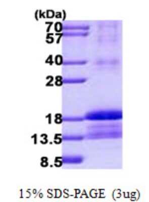 SDS-PAGE: Recombinant Human ID2 His Protein [NBP2-23139]