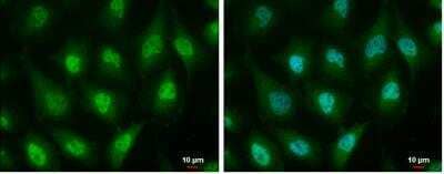 Immunocytochemistry/ Immunofluorescence: ID3 Antibody (2B11) [NB500-112]