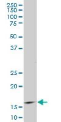 Western Blot: ID3 Antibody (2H8) [H00003399-M03]