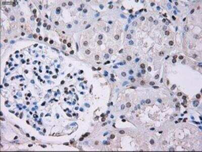 Immunohistochemistry-Paraffin: ID3 Antibody (OTI8B3) [NBP2-02136]