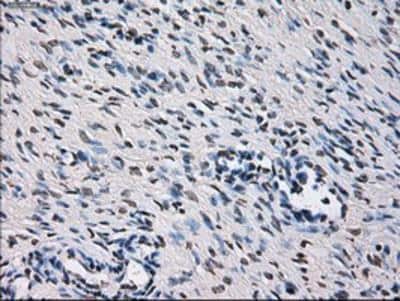 Immunohistochemistry-Paraffin: ID3 Antibody (OTI8B3) [NBP2-02136]
