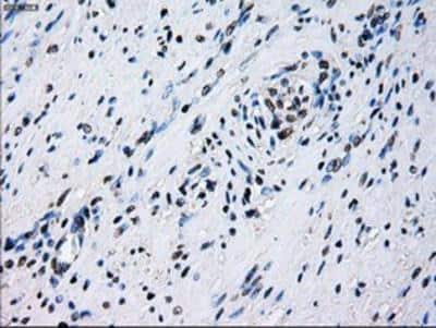 Immunohistochemistry-Paraffin: ID3 Antibody (OTI8B3) [NBP2-02136]