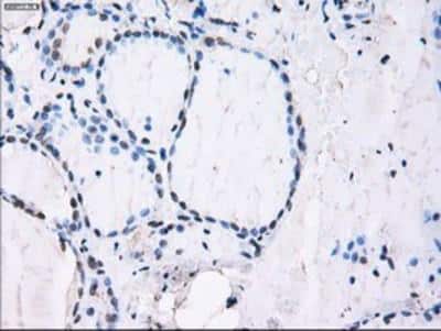 Immunohistochemistry-Paraffin: ID3 Antibody (OTI8B3) [NBP2-02136]