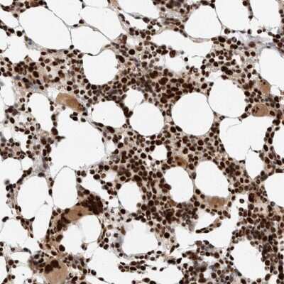 Immunohistochemistry-Paraffin: ID3 Antibody [NBP2-47423]