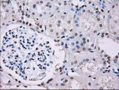 Immunohistochemistry: ID3 Antibody (OTI8B3) - Azide and BSA Free [NBP2-70979]