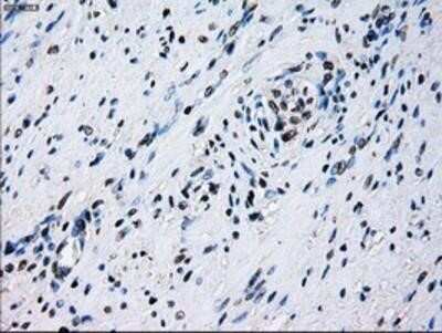 Immunohistochemistry: ID3 Antibody (OTI8B3) - Azide and BSA Free [NBP2-70979]