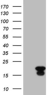 Western Blot: ID4 Antibody (OTI2G10) [NBP2-46017]