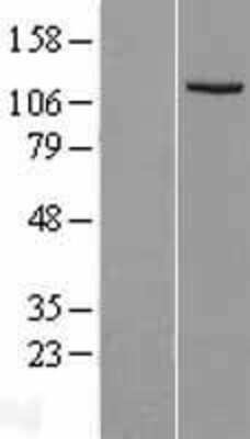 Western Blot: Insulysin/IDE Overexpression Lysate [NBL1-11816]