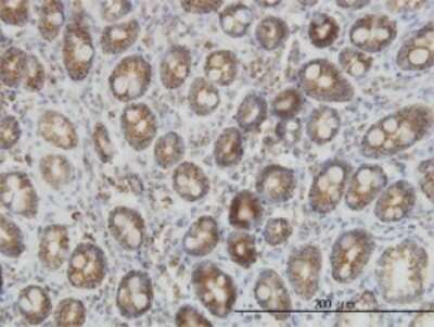 Immunohistochemistry-Paraffin: IDH2 Antibody (5F11) [H00003418-M01]