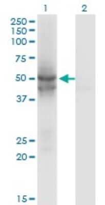 Western Blot: IDH2 Antibody (5F11) [H00003418-M01]