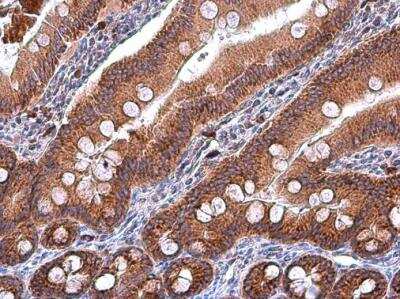 Immunohistochemistry-Paraffin: IDH2 Antibody (673) [NBP2-43572]