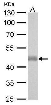 Western Blot: IDH2 Antibody (673) [NBP2-43572]