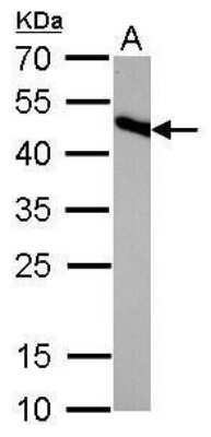 Western Blot: IDH2 Antibody (673) [NBP2-43572]
