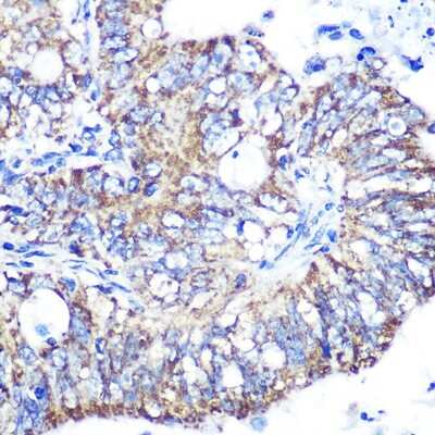 Immunohistochemistry-Paraffin: IDH2 Antibody (8C3D4) [NBP3-15366]