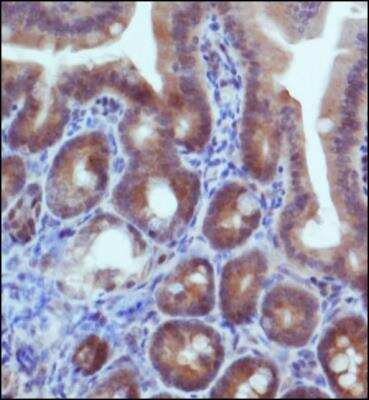 Immunohistochemistry: IDH2 Antibody - BSA Free [NBP2-22166]
