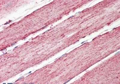 Immunohistochemistry-Paraffin: IDH2 Antibody [NBP1-52117]