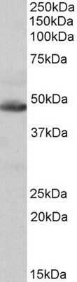 Western Blot: IDH2 Antibody [NBP1-52117]
