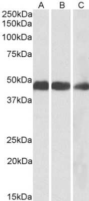 Western Blot: IDH2 Antibody [NBP1-52117]