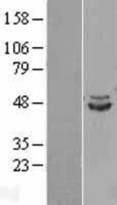 Western Blot: IDH2 Overexpression Lysate [NBL1-11818]