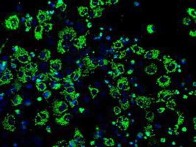 Immunocytochemistry/ Immunofluorescence: IDH3A Antibody (OTI2F11) [NBP2-02158]